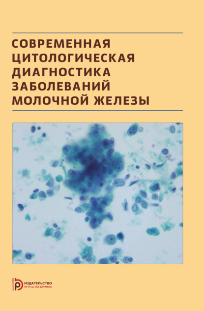 Скачать книгу Современная цитологическая диагностика заболеваний молочной железы