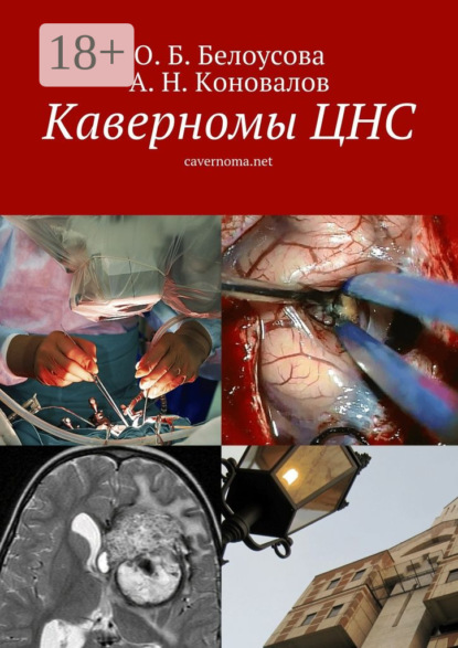 Скачать книгу Каверномы ЦНС. cavernoma.net