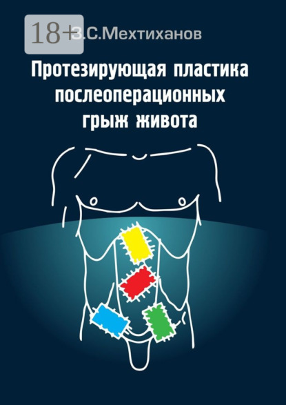Скачать книгу Протезирующая пластика послеоперационных грыж живота