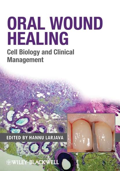 Скачать книгу Oral Wound Healing. Cell Biology and Clinical Management
