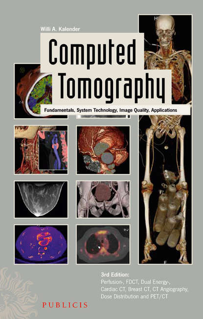 Скачать книгу Computed Tomography. Fundamentals, System Technology, Image Quality, Applications