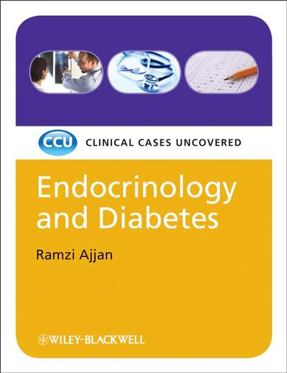 Скачать книгу Endocrinology and Diabetes, eTextbook. Clinical Cases Uncovered