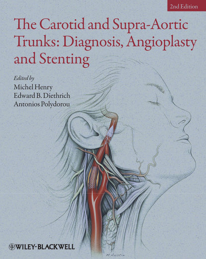 Скачать книгу The Carotid and Supra-Aortic Trunks. Diagnosis, Angioplasty and Stenting
