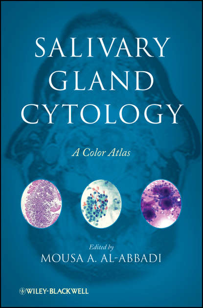 Скачать книгу Salivary Gland Cytology. A Color Atlas