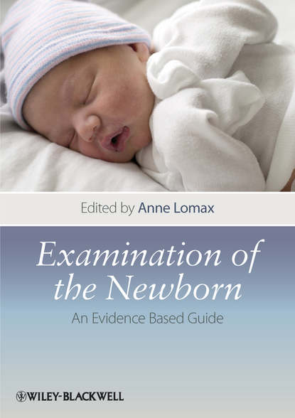 Скачать книгу Examination of the Newborn. An Evidence Based Guide