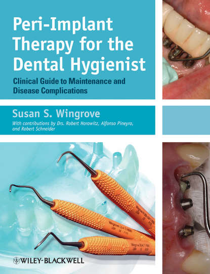 Скачать книгу Peri-Implant Therapy for the Dental Hygienist. Clinical Guide to Maintenance and Disease Complications