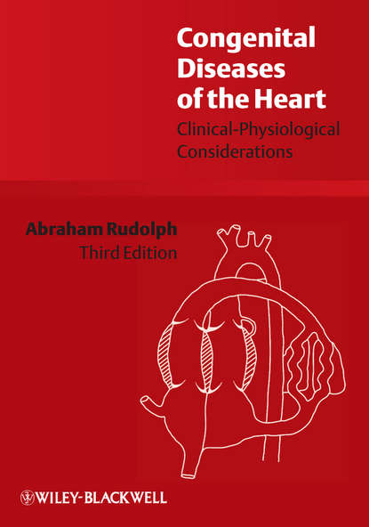 Скачать книгу Congenital Diseases of the Heart. Clinical-Physiological Considerations