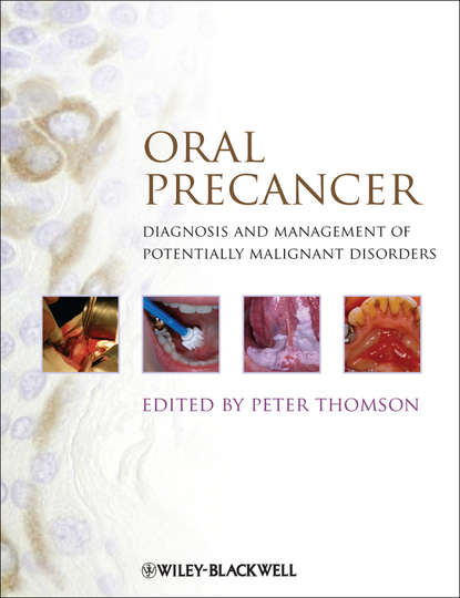 Скачать книгу Oral Precancer. Diagnosis and Management of Potentially Malignant Disorders