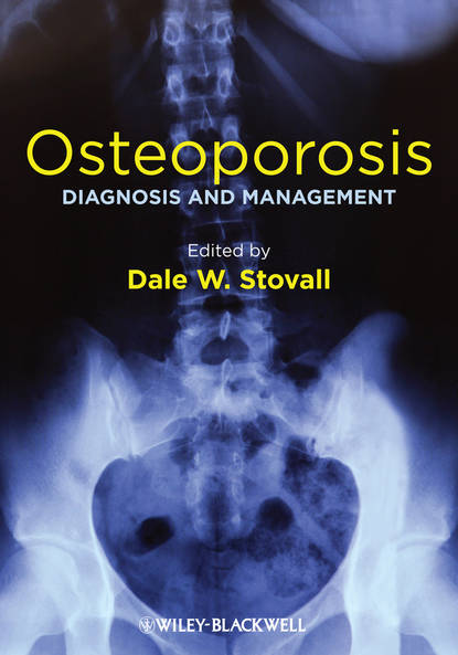 Скачать книгу Osteoporosis. Diagnosis and Management