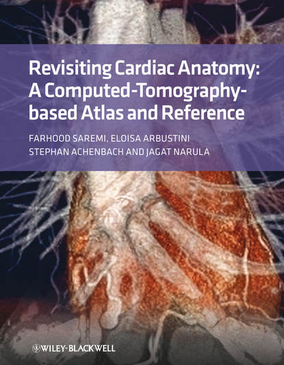Скачать книгу Revisiting Cardiac Anatomy. A Computed-Tomography-Based Atlas and Reference