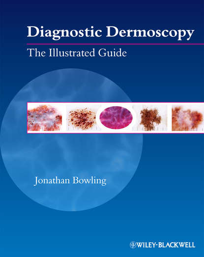 Скачать книгу Diagnostic Dermoscopy. The Illustrated Guide