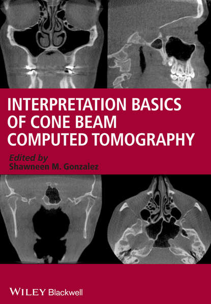 Скачать книгу Interpretation Basics of Cone Beam Computed Tomography