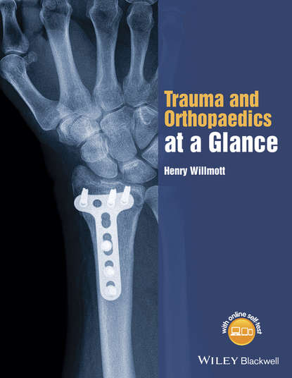 Скачать книгу Trauma and Orthopaedics at a Glance