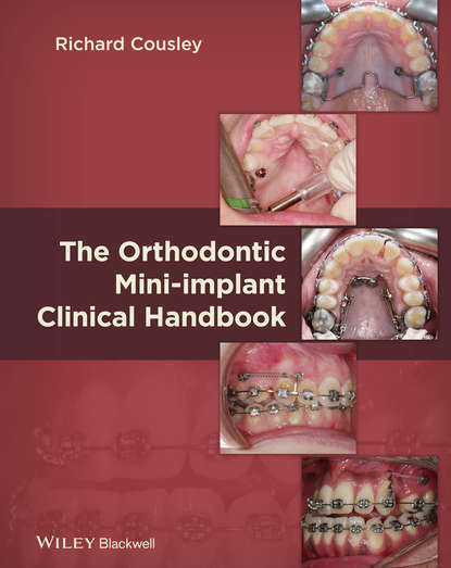 Скачать книгу The Orthodontic Mini-implant Clinical Handbook