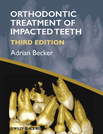 Скачать книгу Orthodontic Treatment of Impacted Teeth