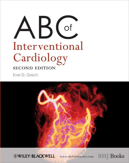 Скачать книгу ABC of Interventional Cardiology
