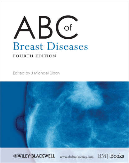 Скачать книгу ABC of Breast Diseases