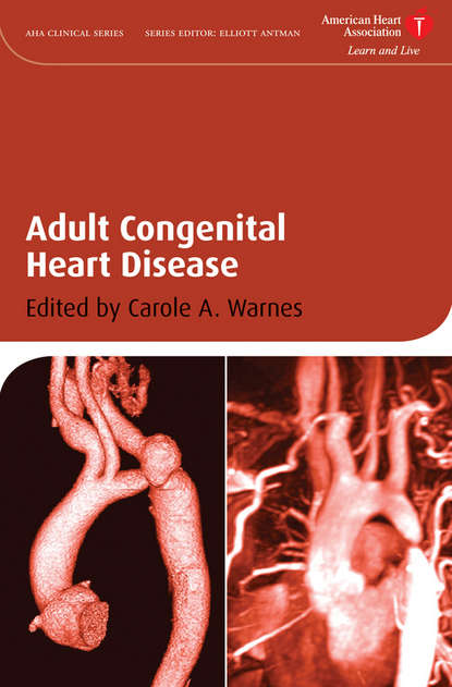 Скачать книгу Adult Congenital Heart Disease