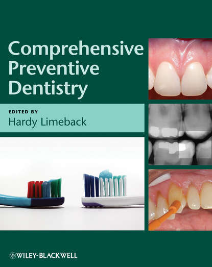 Скачать книгу Comprehensive Preventive Dentistry