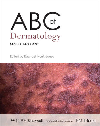 Скачать книгу ABC of Dermatology