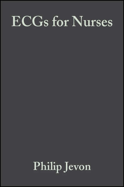 Скачать книгу ECGs for Nurses