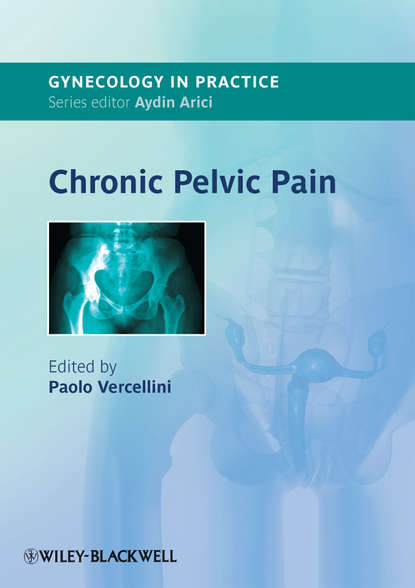 Скачать книгу Chronic Pelvic Pain