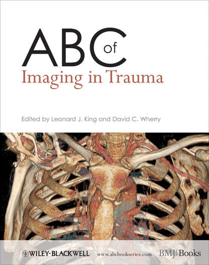 Скачать книгу ABC of Imaging in Trauma