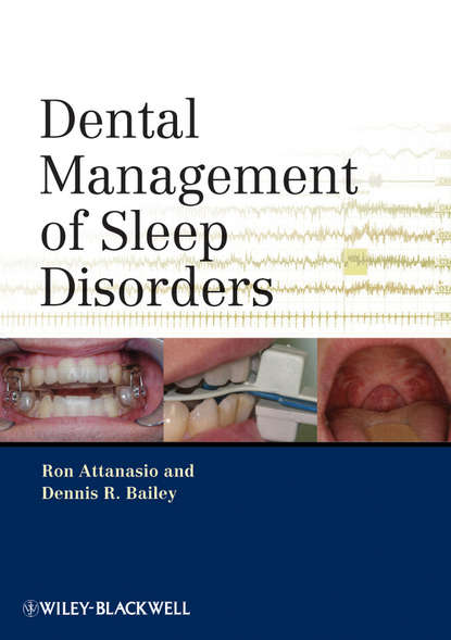 Скачать книгу Dental Management of Sleep Disorders