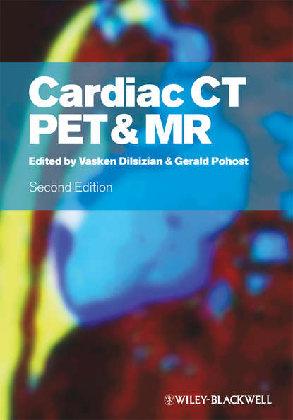 Скачать книгу Cardiac CT, PET and MR
