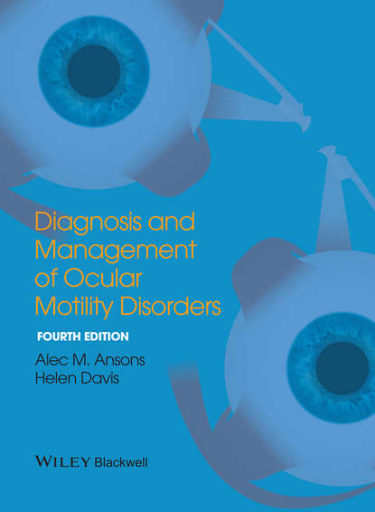 Скачать книгу Diagnosis and Management of Ocular Motility Disorders