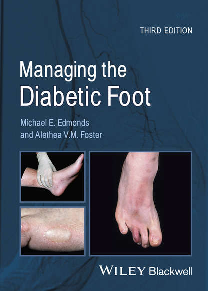 Скачать книгу Managing the Diabetic Foot