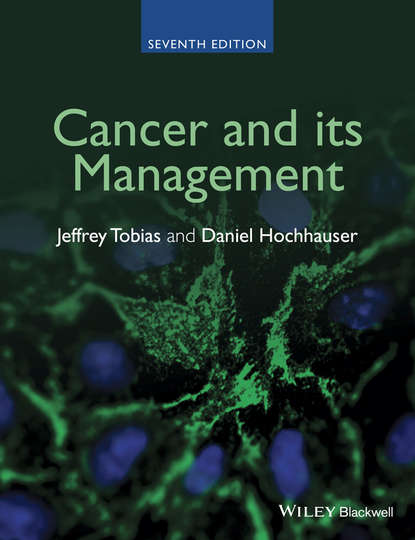 Скачать книгу Cancer and its Management