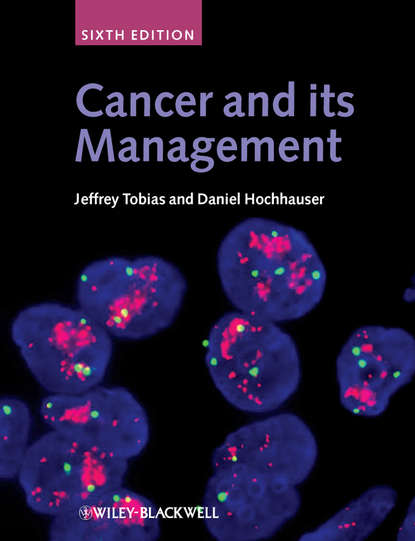 Скачать книгу Cancer and its Management
