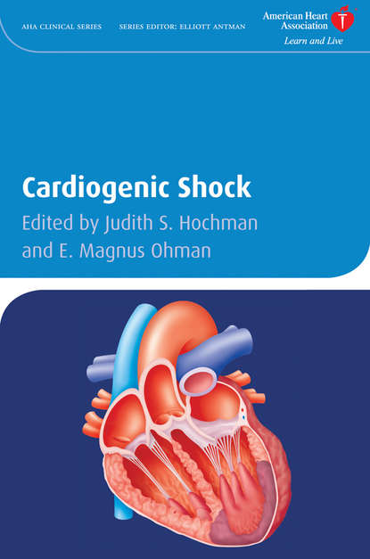Скачать книгу Cardiogenic Shock
