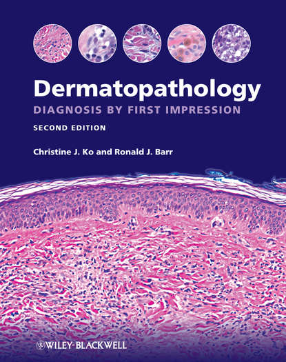 Скачать книгу Dermatopathology. Diagnosis by First Impression