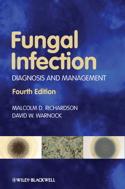 Скачать книгу Fungal Infection. Diagnosis and Management