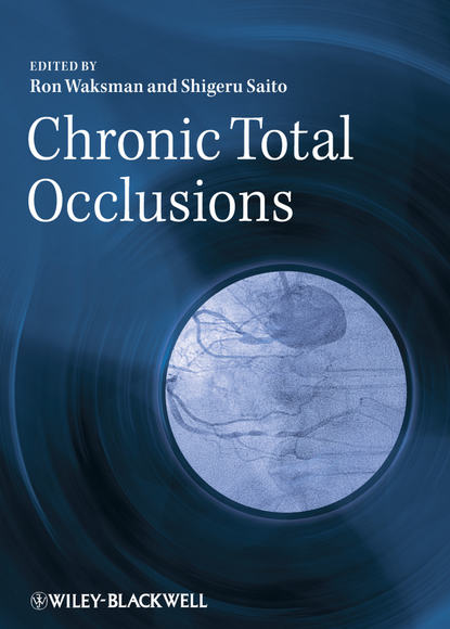 Скачать книгу Chronic Total Occlusions. A Guide to Recanalization