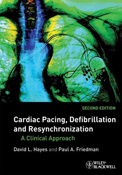 Скачать книгу Cardiac Pacing, Defibrillation and Resynchronization. A Clinical Approach