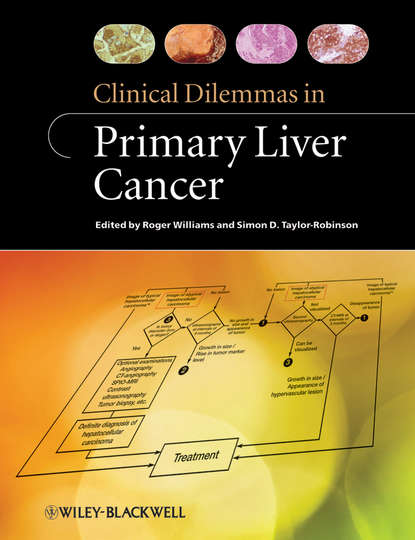 Скачать книгу Clinical Dilemmas in Primary Liver Cancer