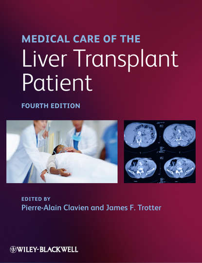 Скачать книгу Medical Care of the Liver Transplant Patient