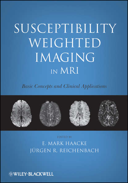 Скачать книгу Susceptibility Weighted Imaging in MRI. Basic Concepts and Clinical Applications