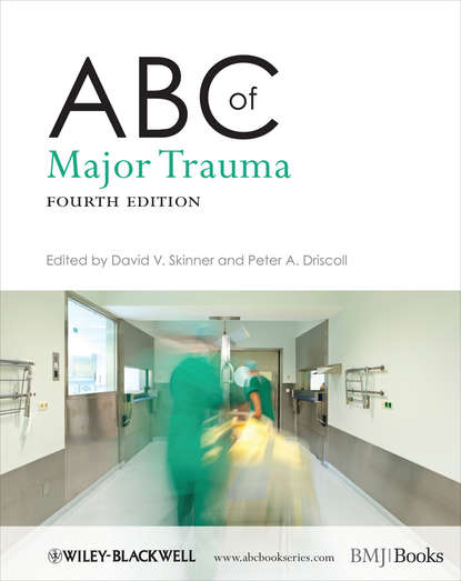 Скачать книгу ABC of Major Trauma