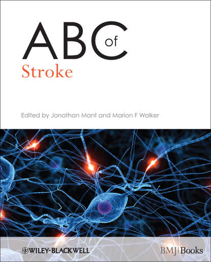 Скачать книгу ABC of Stroke
