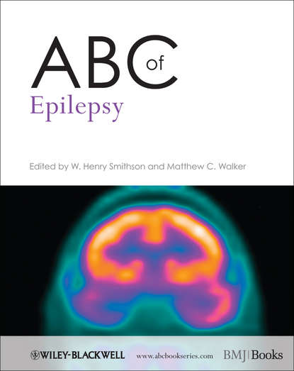 Скачать книгу ABC of Epilepsy
