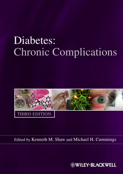 Скачать книгу Diabetes Chronic Complications
