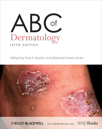 Скачать книгу ABC of Dermatology