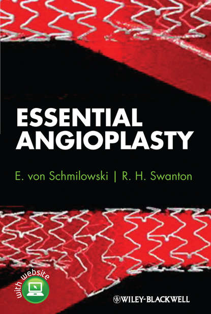 Скачать книгу Essential Angioplasty