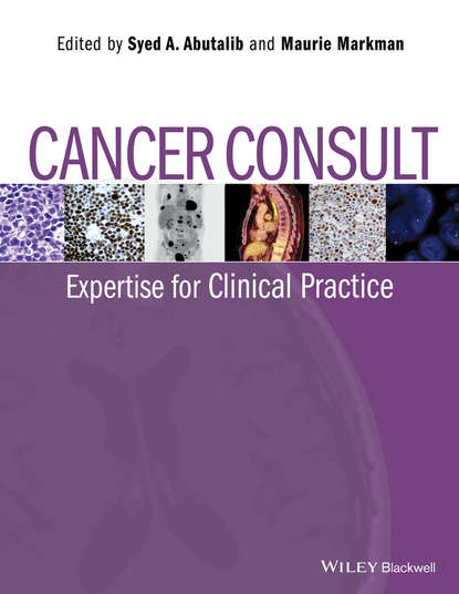 Cancer Consult. Expertise for Clinical Practice