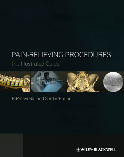 Скачать книгу Pain-Relieving Procedures. The Illustrated Guide