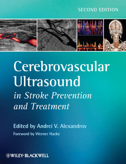 Скачать книгу Cerebrovascular Ultrasound in Stroke Prevention and Treatment